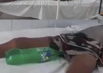 Cold drink bottle used as uro-bag on patient