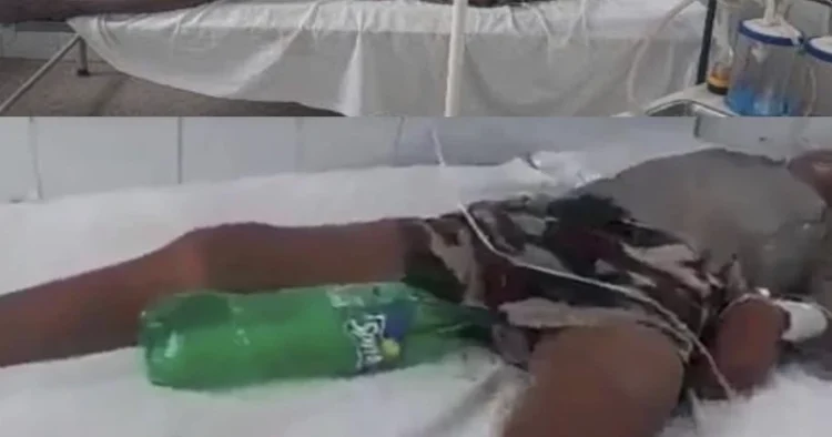 Cold drink bottle used as uro-bag on patient