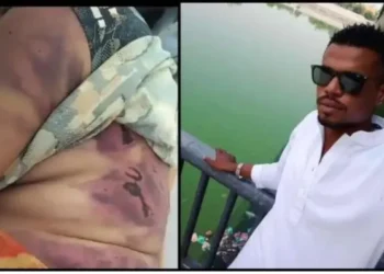 Hindu woman after being beaten up (L) and Firoz (R) (Zee)