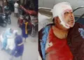 Shiv Sena Punjab leader Sandeep Thapar attacked by Nihangs in Ludhiana (Image Source: X)