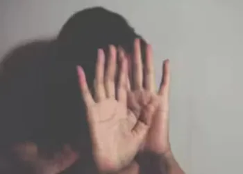 A representative image