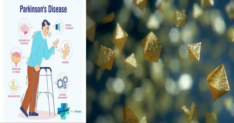 Gold Nanoclusters: A New Hope for Early Detection of Parkinson’s Disease