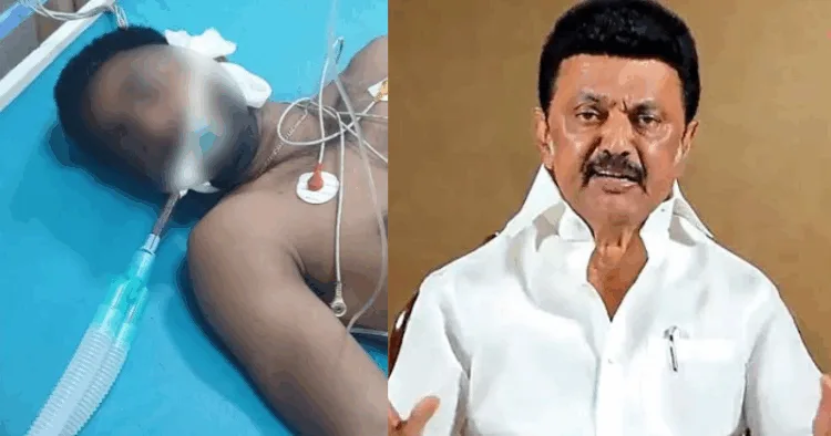 Severly injured migrant worker from West Bengal (Left) TN CM MK Stalin (Right)