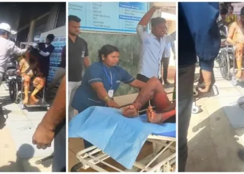 People injured in boiler accident at Belagavi sugar factory being treated at the hospital