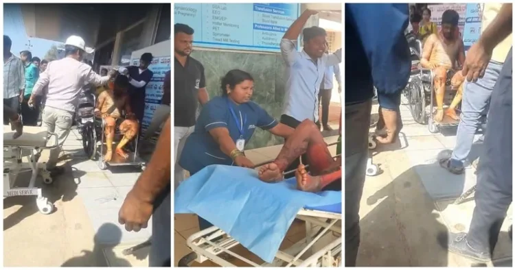 People injured in boiler accident at Belagavi sugar factory being treated at the hospital