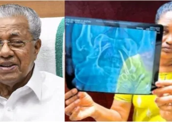 Kerala CM Pinarayi Vijayan–led Left government faces mounting outrage after an Usha revealed surgical scissors left inside her body for five years, as she displays the X-ray exposing the medical lapse