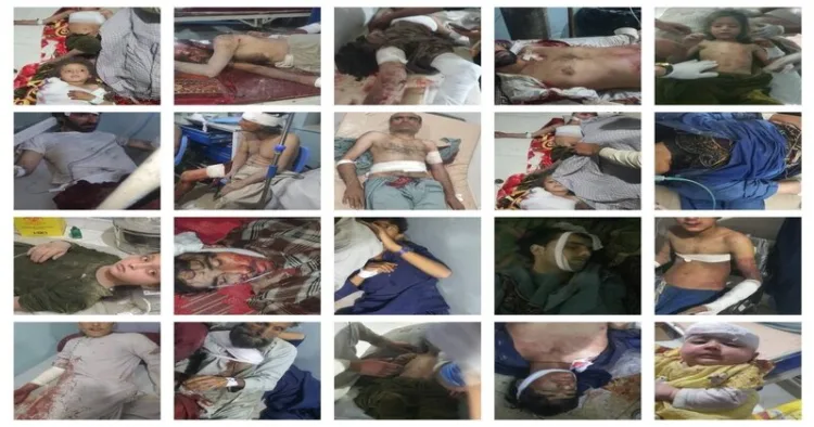 Civilians injured in Afghanistan after Pakistan airstrike