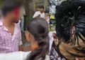 ABVP members injured during a clash with NSUI supporters during DUSU poll campaign