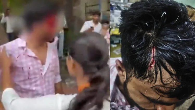 ABVP members injured during a clash with NSUI supporters during DUSU poll campaign