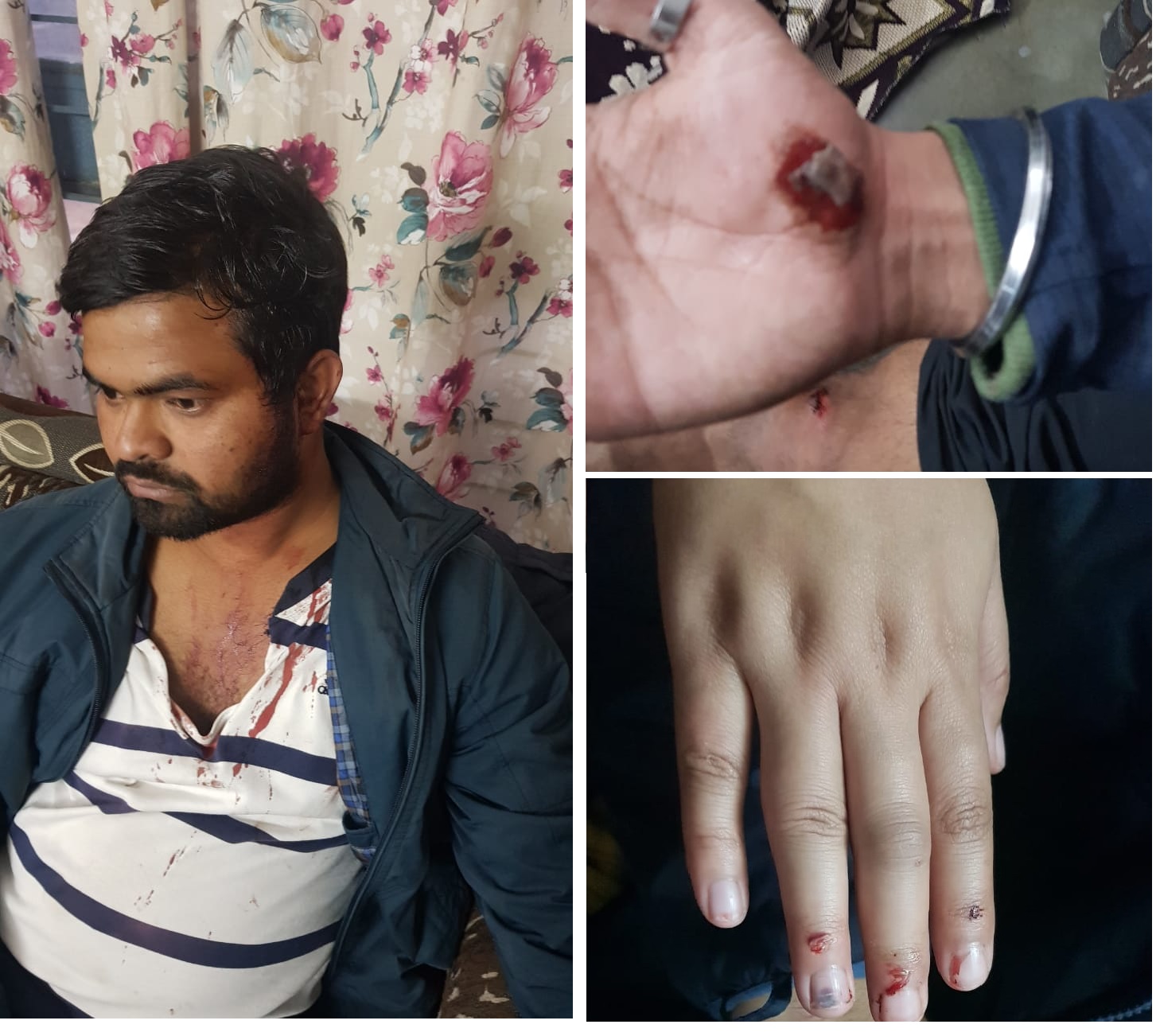 ABVP student attacked_1&n