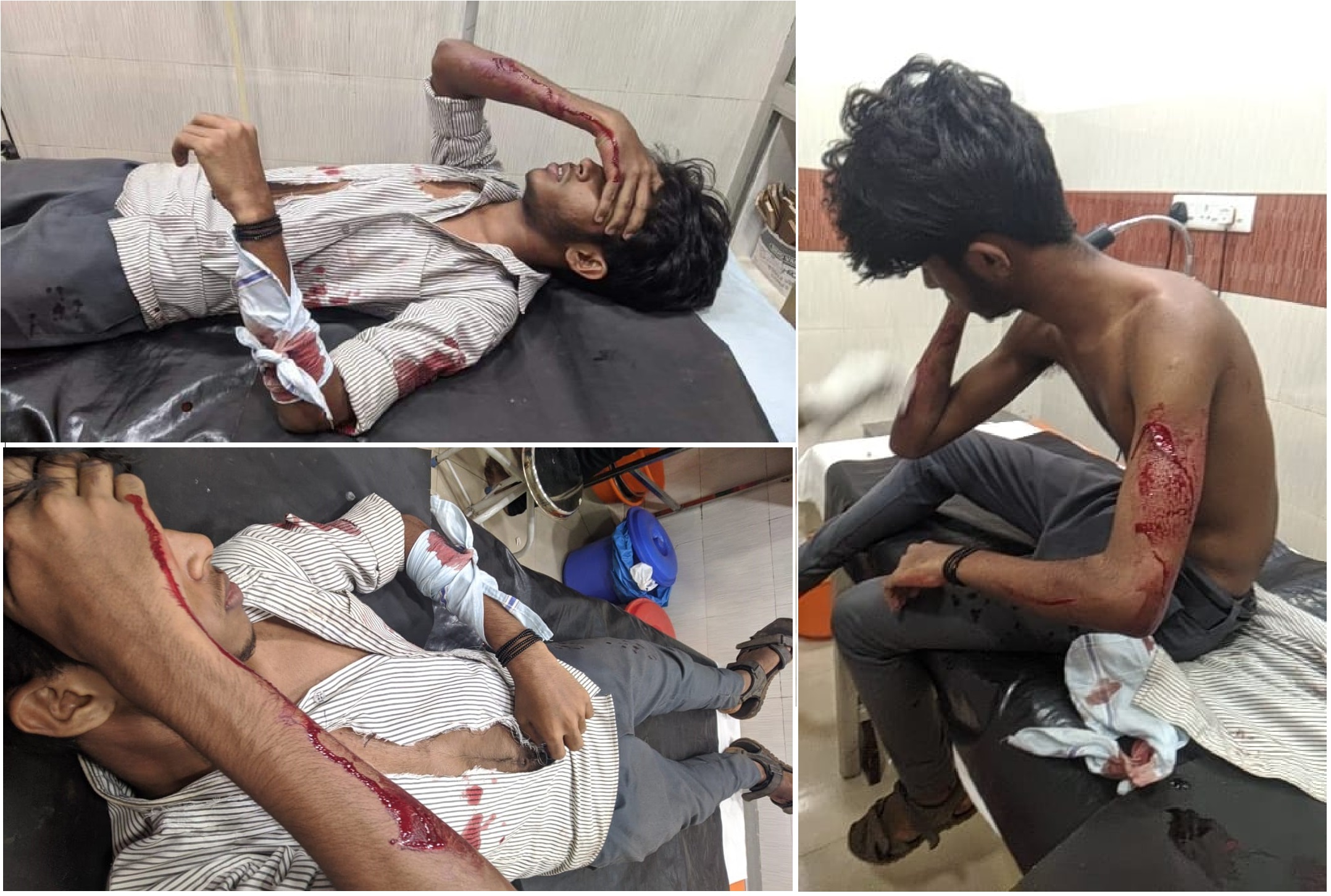 ABVP attacked_1 &nbs
